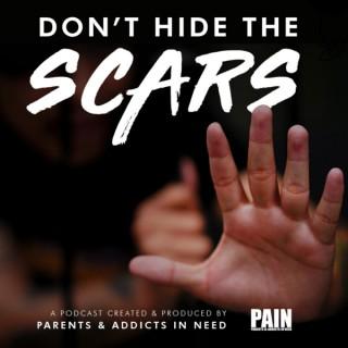 Donâ€™t Hide The Scars