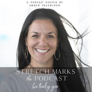 The Stretch Marks Podcast