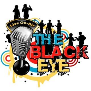 The Black Eye Show * Call (424) 675-8263