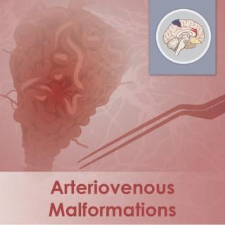 Arteriovenous Malformations
