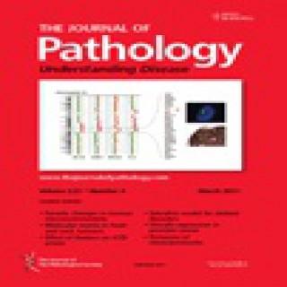 Podcasts from The Journal of Pathology