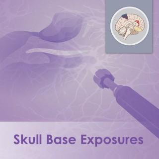 Skull Base Exposures