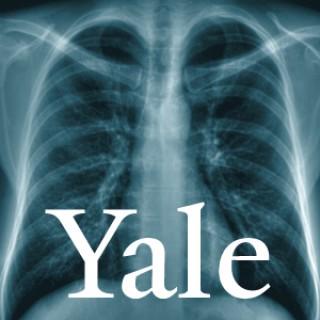 Yale Healthcasts