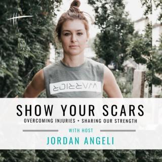 Show Your Scars