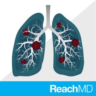 Closing the Gaps in NSCLC