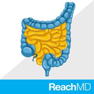 Conversations on Colorectal Cancer